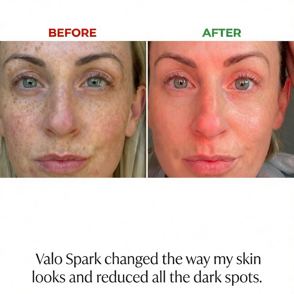 How Red Light Therapy Helps Reduce Acne and Cystic Acne