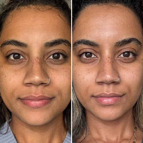 Brighten Complexion Before and After